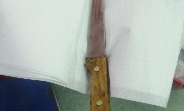 طوارئ قصر العينى تستخرج سكينا من ظهر سيدة في جراحة خطرة 1 IMG 20230413 WA0076