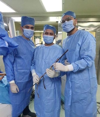 طوارئ قصر العينى ينجح فى إستخراج "سيخ معدني" من عظام الحوض لطفل. 4 almomken.com 3LtcKxGt