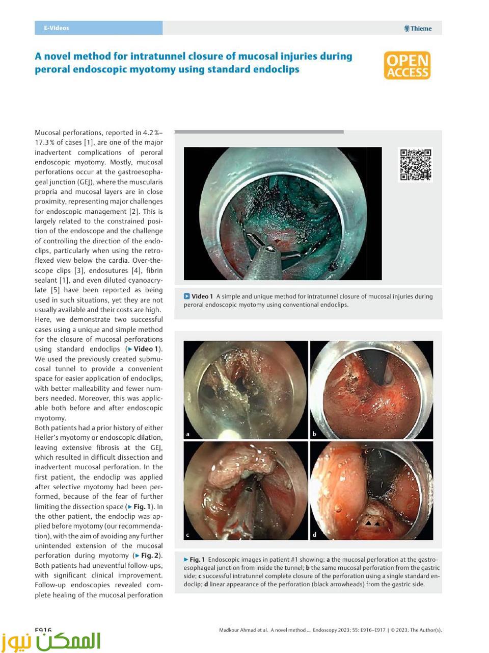 انجاز عالمى اعتماد تقنية "مدكور" عالميًا في مجال مناظير الجهاز الهضمي