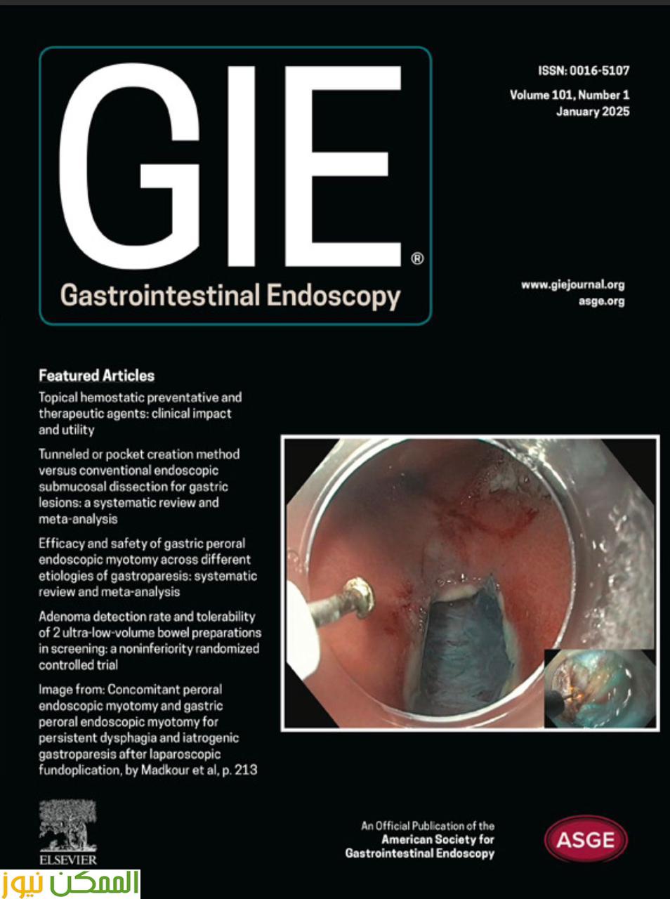 انجاز عالمى اعتماد تقنية "مدكور" عالميًا في مجال مناظير الجهاز الهضمي